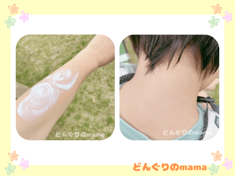 子どもの腕にクリームを塗り広げている様子と、塗り終わった後の首の後ろの肌を並べた比較写真。